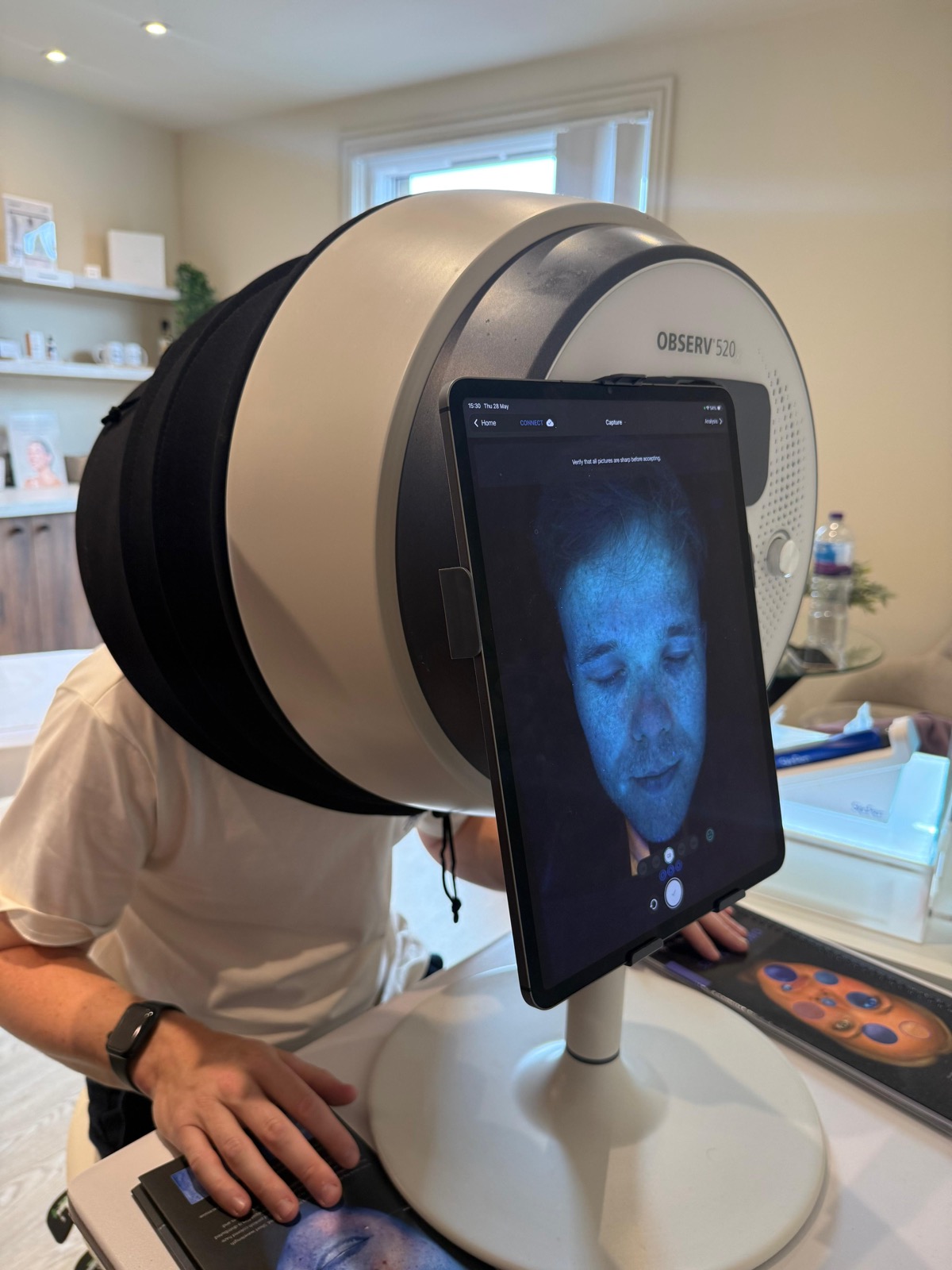 Observ520x skin scan